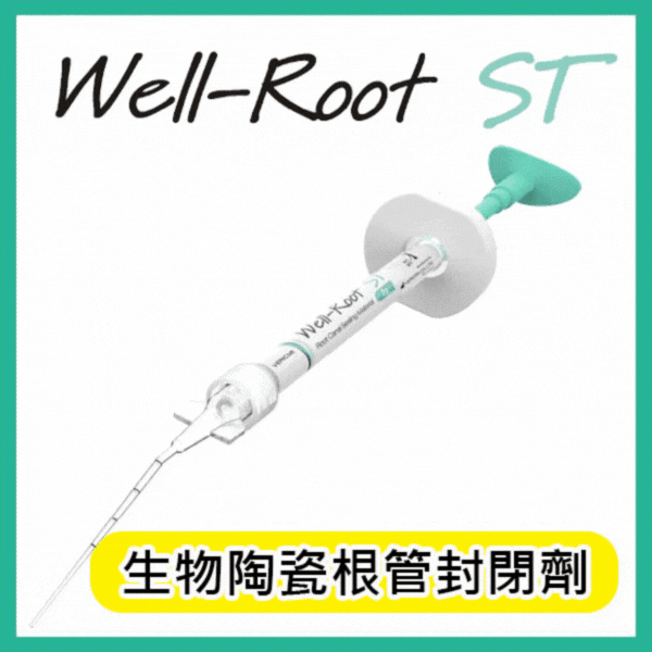 Wellroot ST (BC sealer) 根管封填材